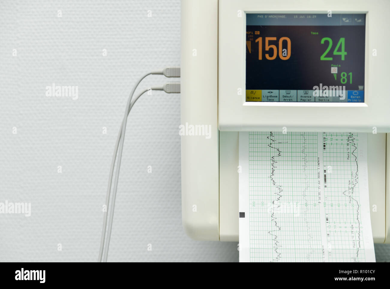 Monitor für die Messung von Kontraktionen, Herzschlag einer schwangeren Frau in einem Krankenhaus Stockfoto