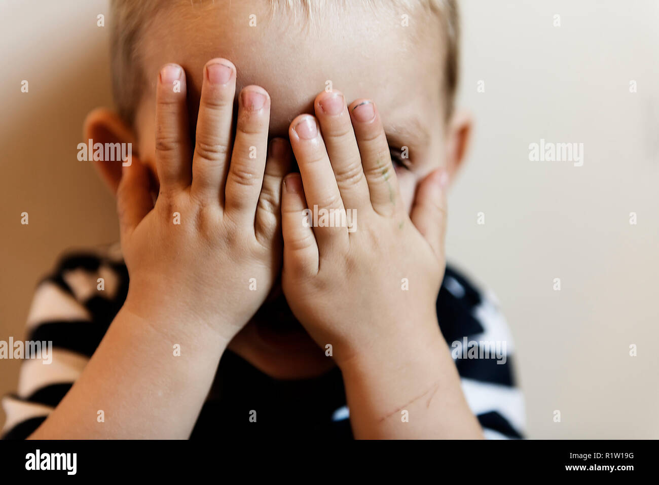 Die Hand auf das Gesicht umgekippt problem Kind Konzept für Mobbing, Depression Stockfoto