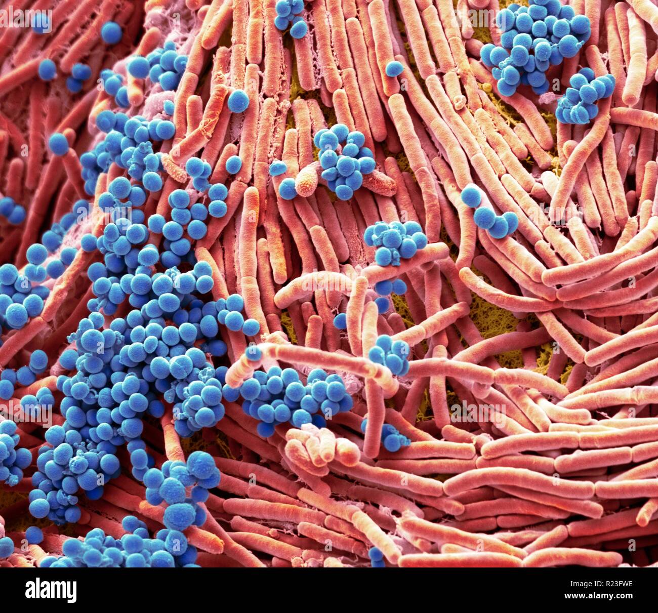 Farbige Scanning Electron Micrograph (SEM) von Bakterien gezüchtet von einem Mobiltelefon. Tests haben gezeigt, dass die durchschnittliche Hörer trägt 18 Mal mehr Po Stockfoto