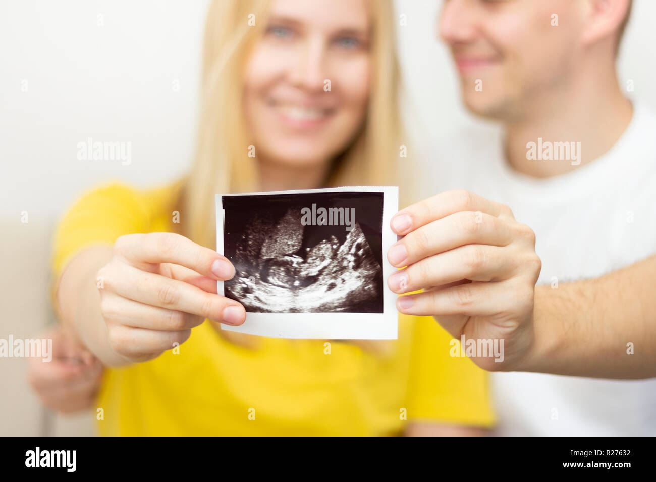 Glückliches junges Paar hält Ultraschallbild Ihres Babys. Stockfoto