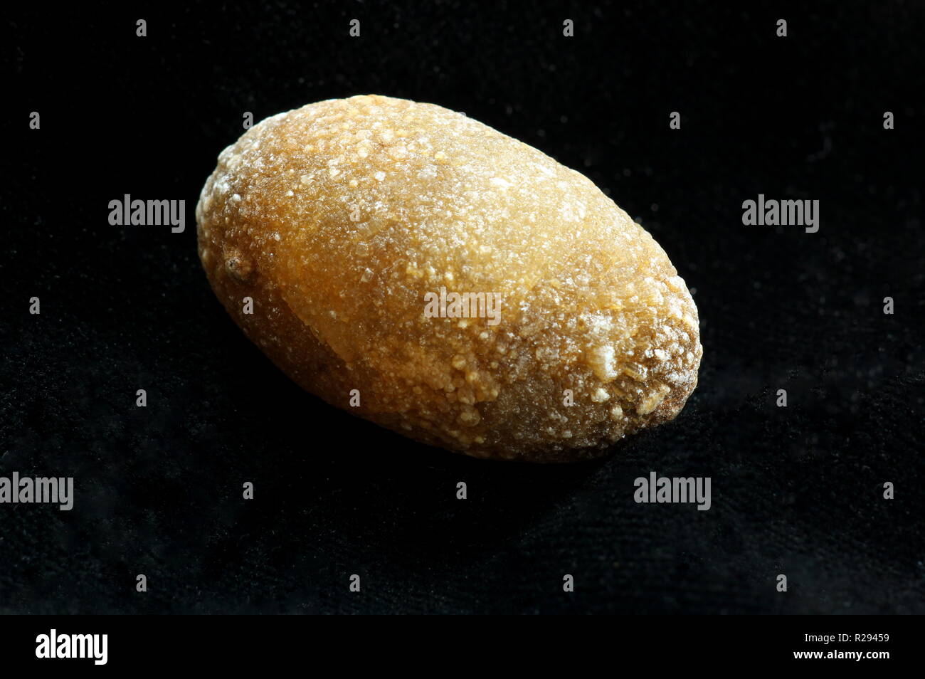 Gallstone Fotos und Bildmaterial in hoher Auflösung Alamy