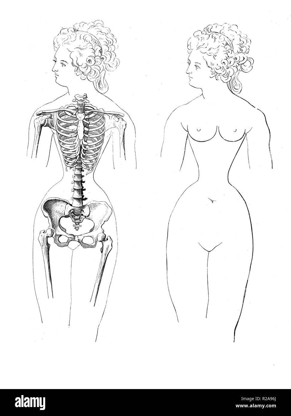 Vintage Abbildung: Anatomie, Brustkorb weiblichen Verformung, durch die modische Verwendung von Korsett Stockfoto