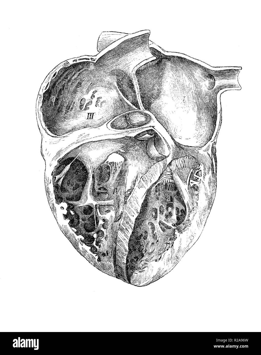 Vintage Abbildung: Anatomie, menschliche Herz Stockfoto