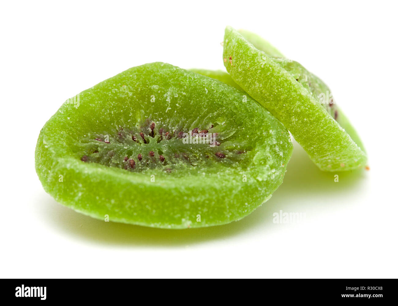 Enfermedad nutricional Fotos und Bildmaterial in hoher Auflösung Alamy