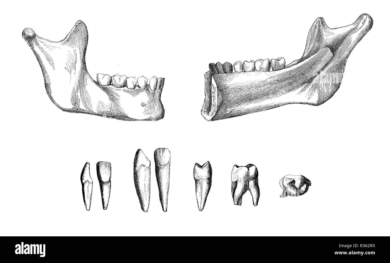 Vintage Abbildung der Anatomie, der rechten unteren Kiefer-, Außen- und Innenansicht mit bleibenden Zähne und die Zähne gesetzt Stockfoto