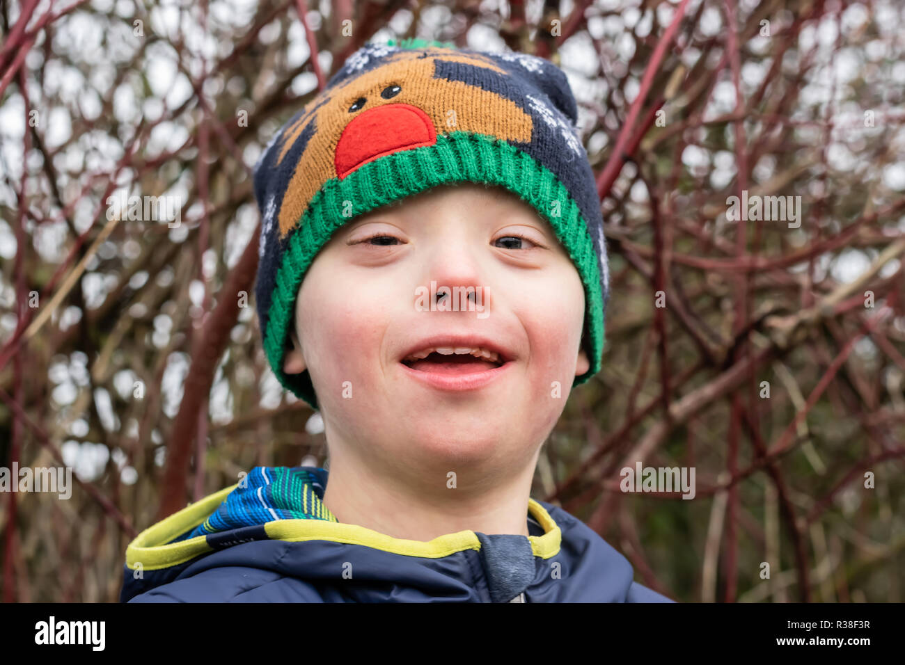 Mangels, Kinderbetreuung, Medizin und Personen Konzept - Junge mit Down-syndrom, die spielen in einem Park. Stockfoto