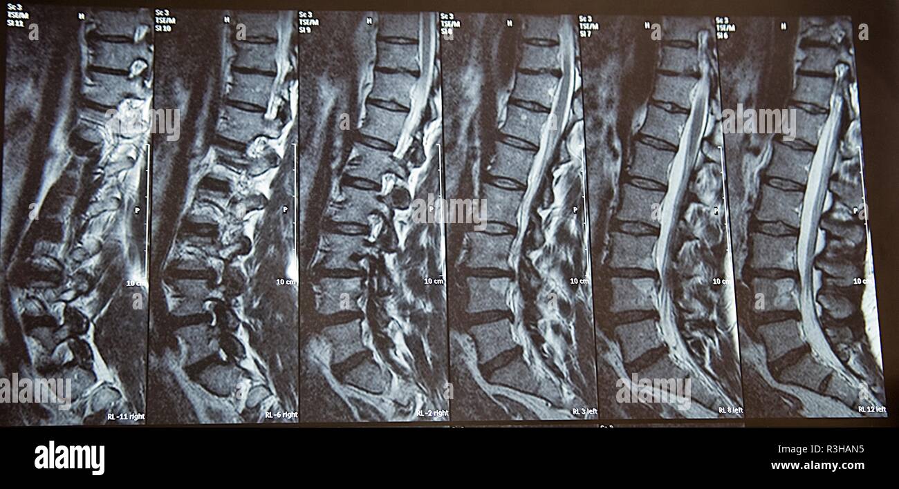 Röntgenaufnahme Stockfoto