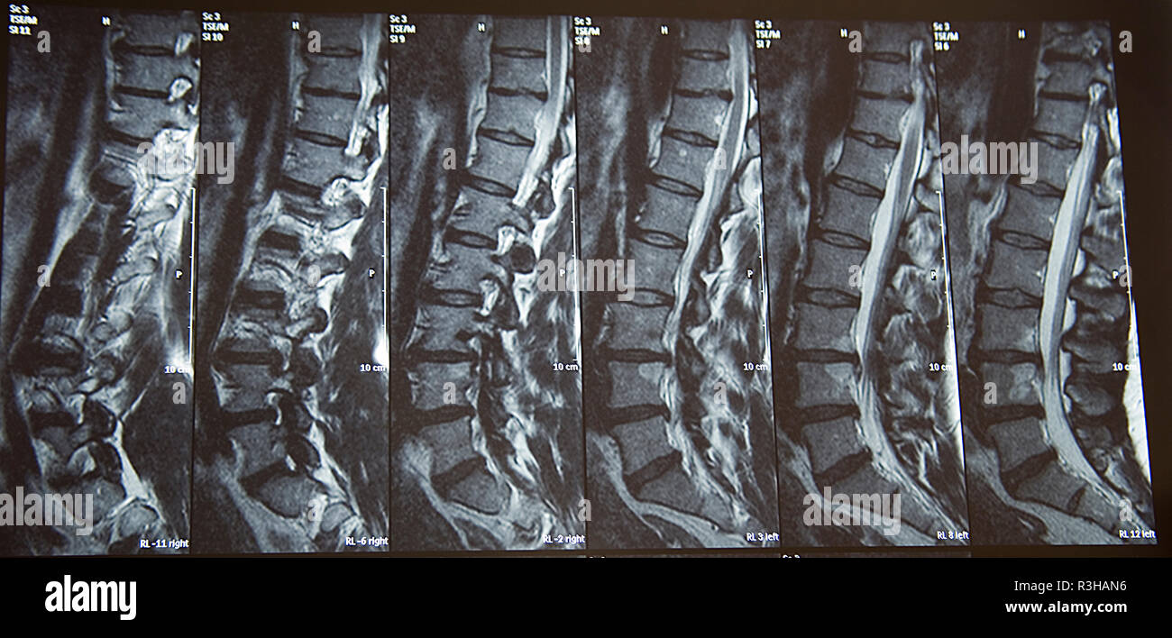 Röntgenaufnahme Stockfoto