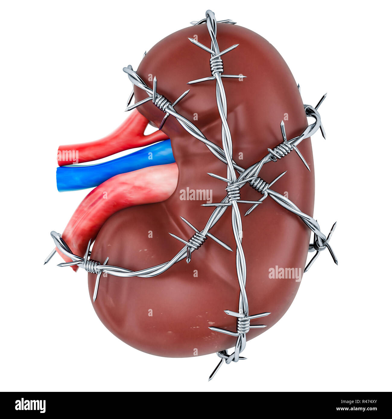 Nierenschmerzen Konzept. Menschliche Niere mit Stacheldraht. 3D-Rendering auf weißem Hintergrund Stockfoto