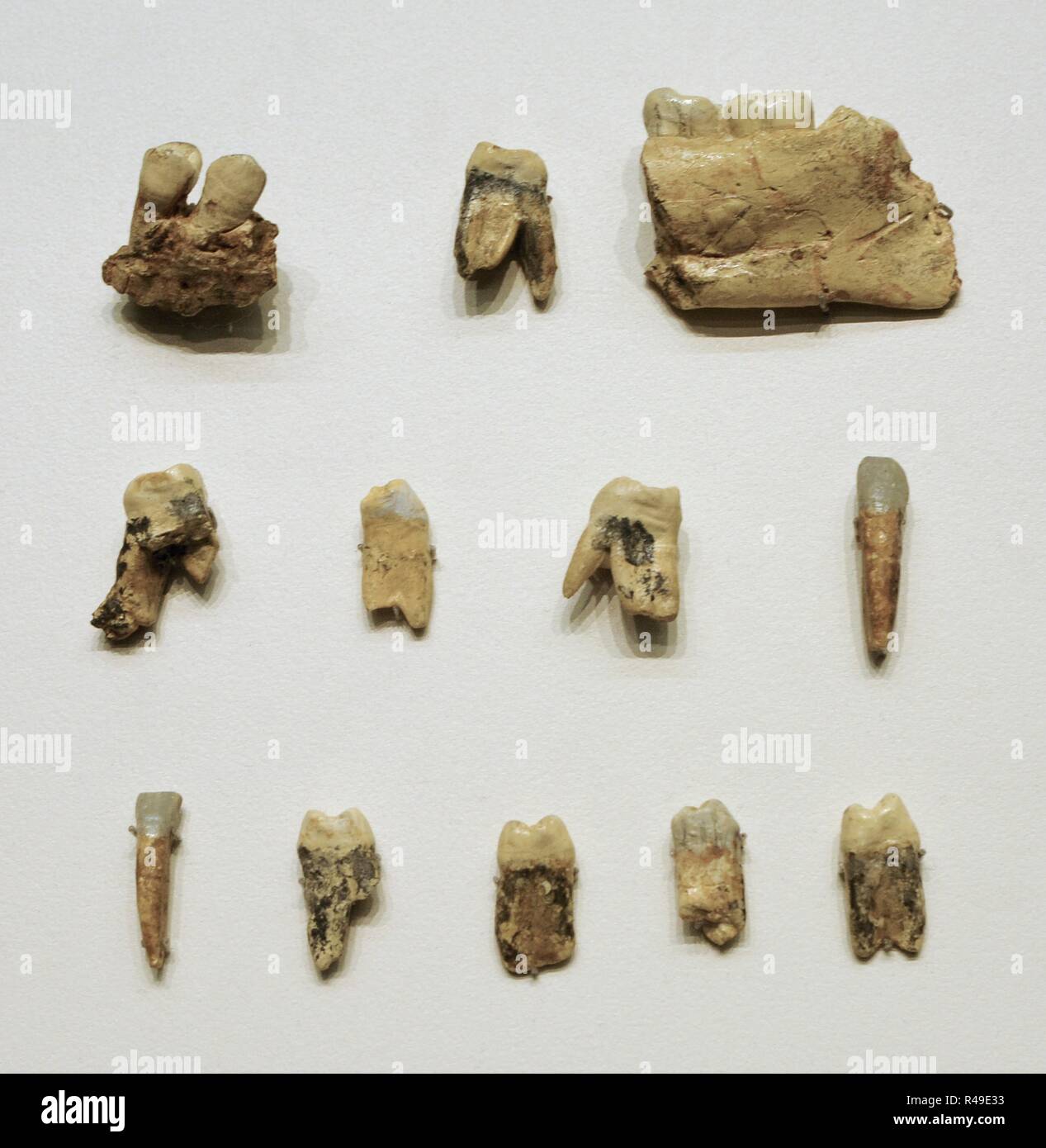 Homo Vorgänger. Zähne und Kiefer Fragmente eines heranwachsenden Männern zwischen 13 und 14 Jahre alt (hominid 1). Unteren Paläolithikum. 900000-800000 BC. Ebene TD6, Gran Dolina. Atapuerca, Burgos Provinz. Nationalen Archäologischen Museum. Madrid. Spanien. Stockfoto