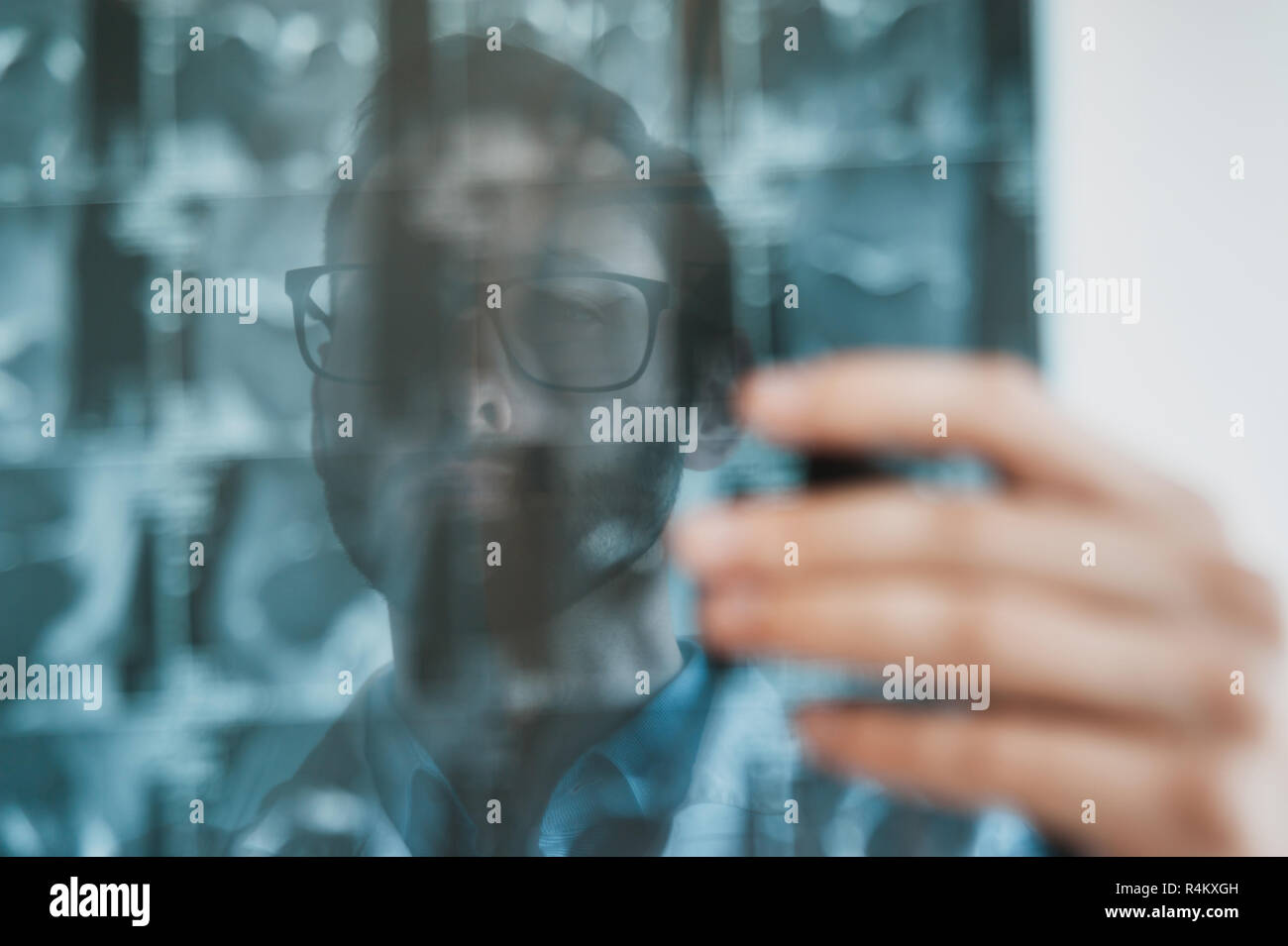 Junge Arzt bei der Magnetresonanztomographie Schuß des Kniegelenk suchen. Meniskus Verletzungen. closeup Stockfoto