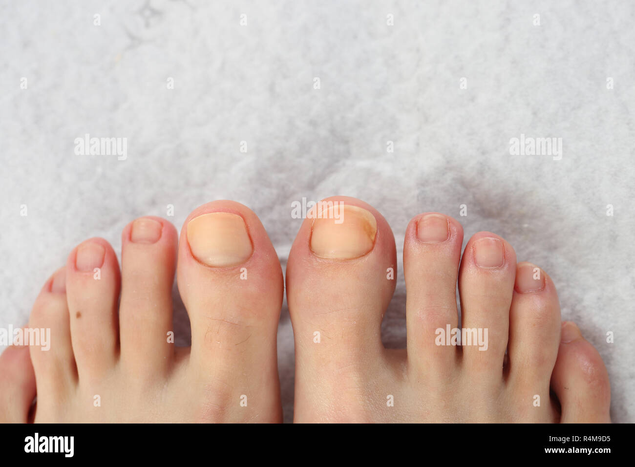 Schöne Füße Pediküre. hygiene der Fingernägel zu Füßen. nagelpflege an den  Füßen Stockfotografie - Alamy