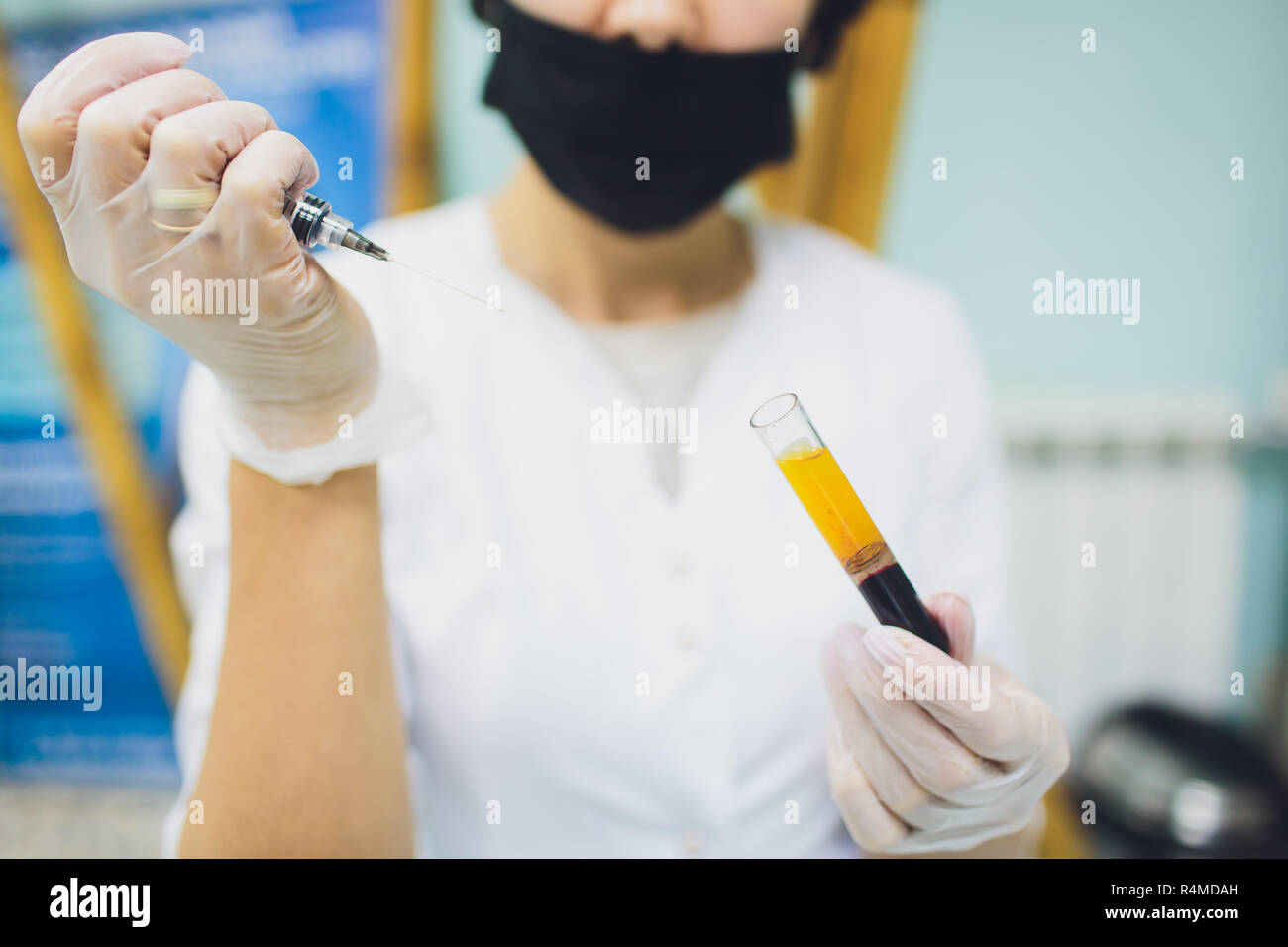 Einstellen der Vorbereitung von Blutplasma aus dem Reagenzglas in einer Spritze von Blutplasma. Stockfoto