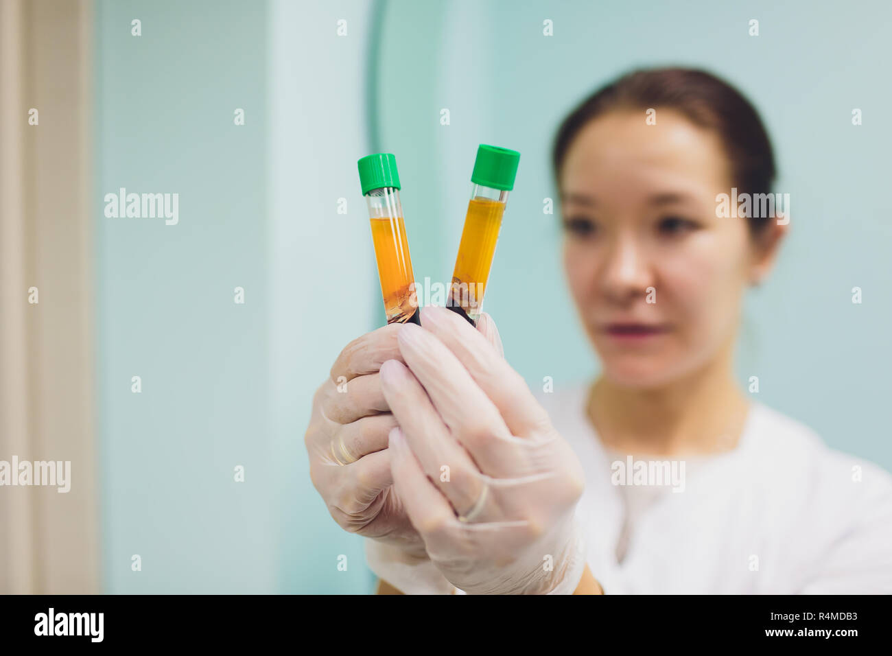 Vorbereitung für Plasmolifting. Blut Rohre in zwei Ebenen geteilt durch die Zentrifuge nach. kosmetische Manipulation. Stockfoto