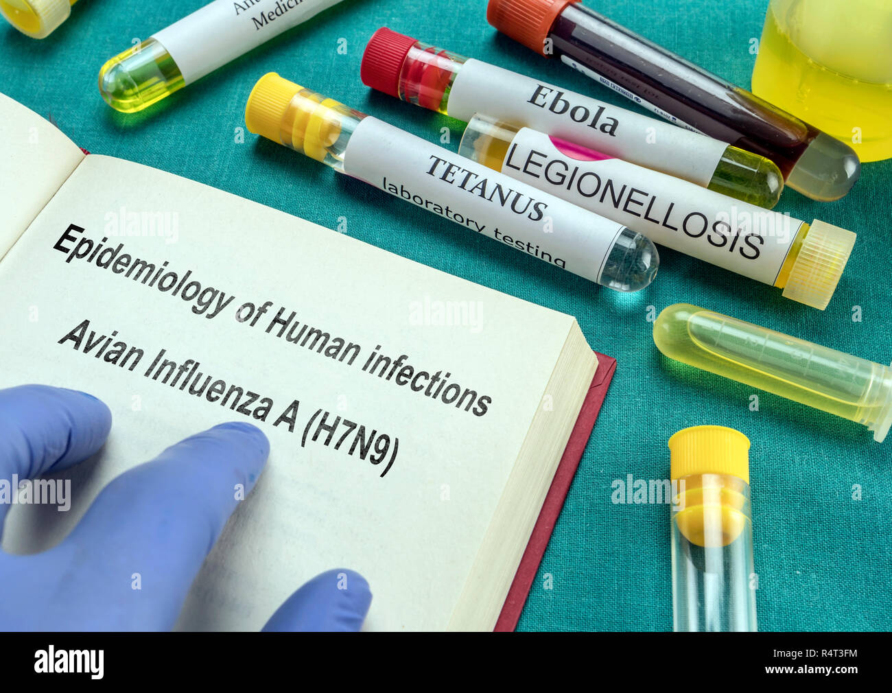 Medizinische Buch Seite der Epidemiologie von Infektionen des Menschen mit aviären Influenza A (H7N9), aktuelle Metaforica Bild Stockfoto