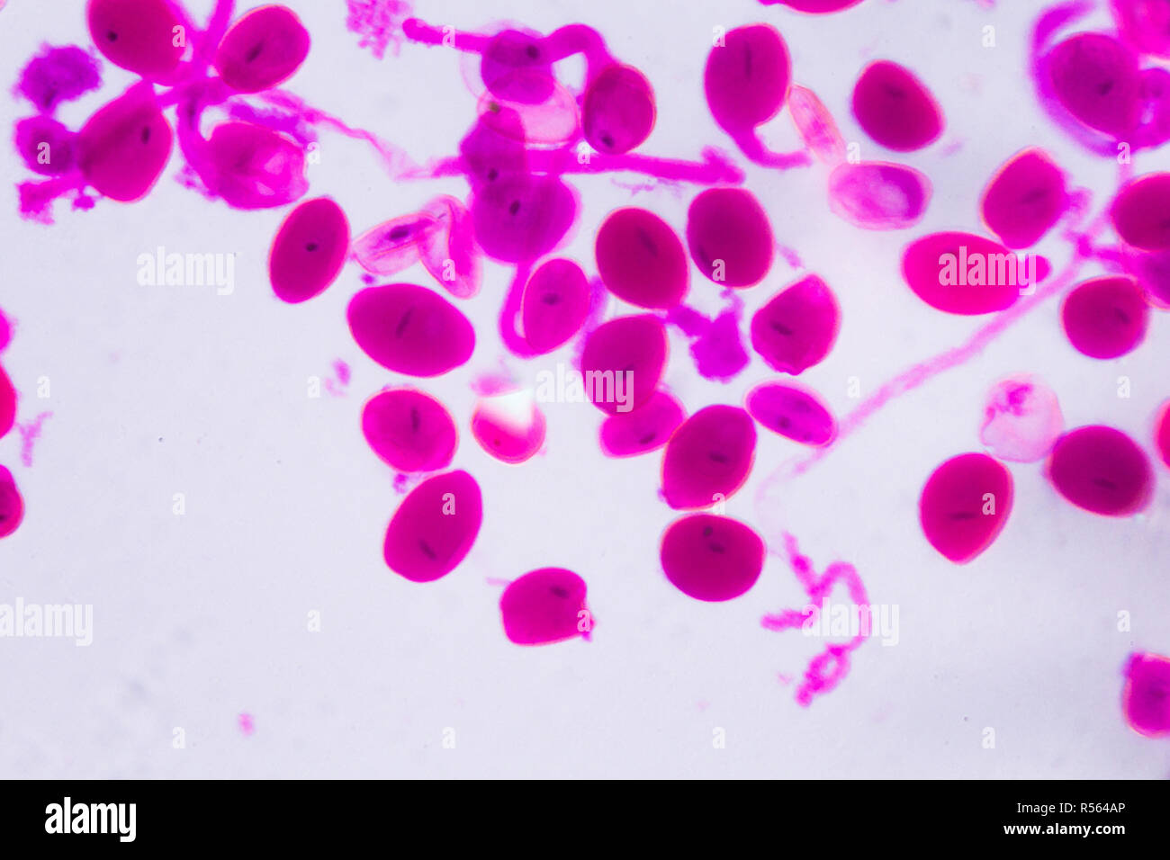 Hemerocallis citrina Reife staubbeutel unter dem Mikroskop - Abstrakte rosa Punkte auf weißem Hintergrund Stockfoto