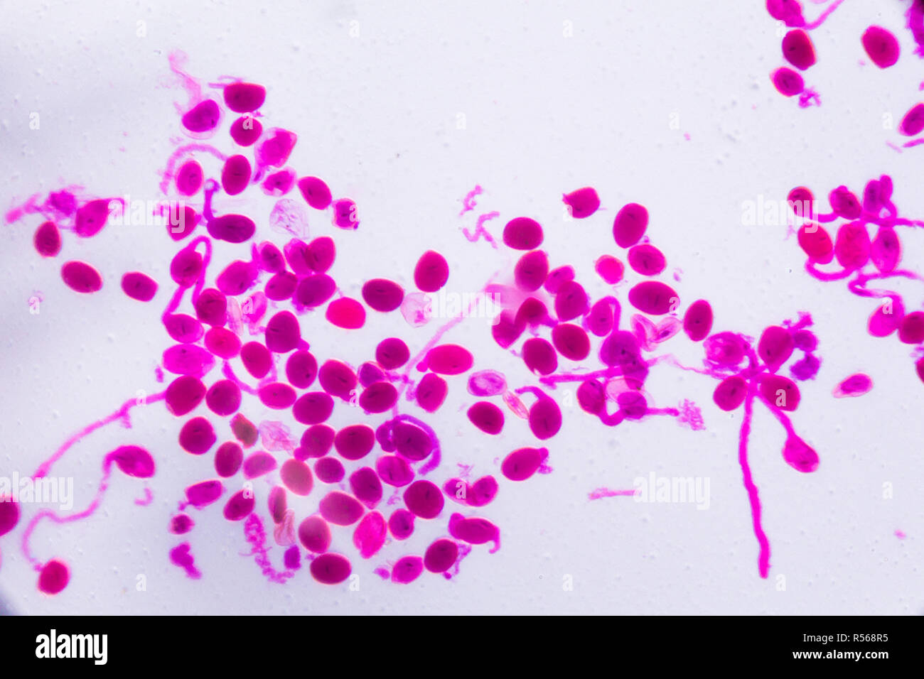 Hemerocallis citrina Reife staubbeutel unter dem Mikroskop - Abstrakte rosa Punkte auf weißem Hintergrund Stockfoto