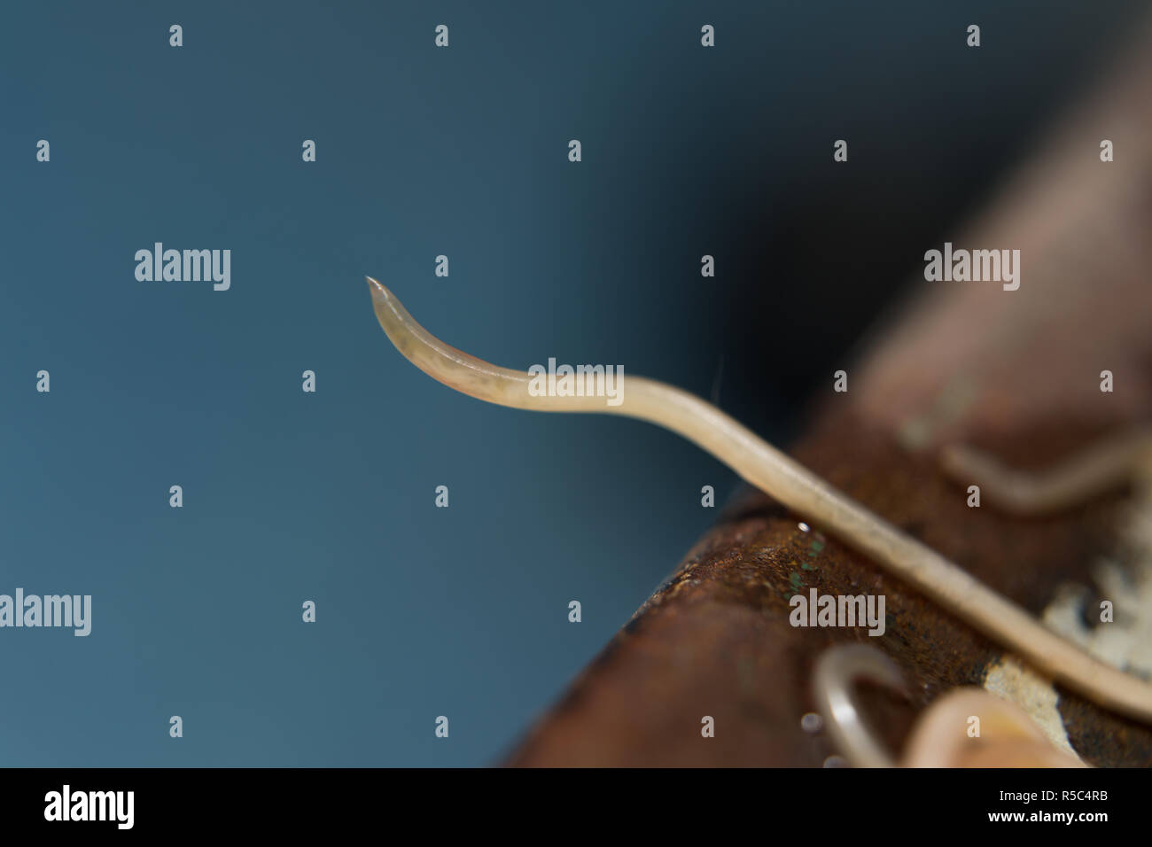 Toxocara Fotos und Bildmaterial in hoher Auflösung Alamy