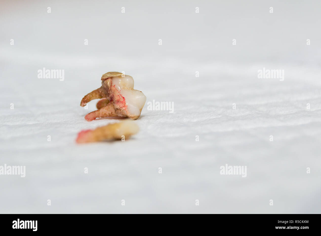 Hund Zahn extrahieren. Zellstoff- Infektion. Zahnstein Stockfoto