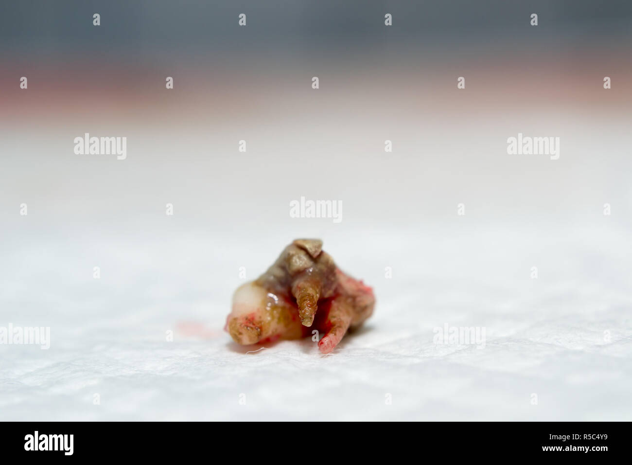 Hund Zahn extrahieren. Zellstoff- Infektion. Zahnstein Stockfoto