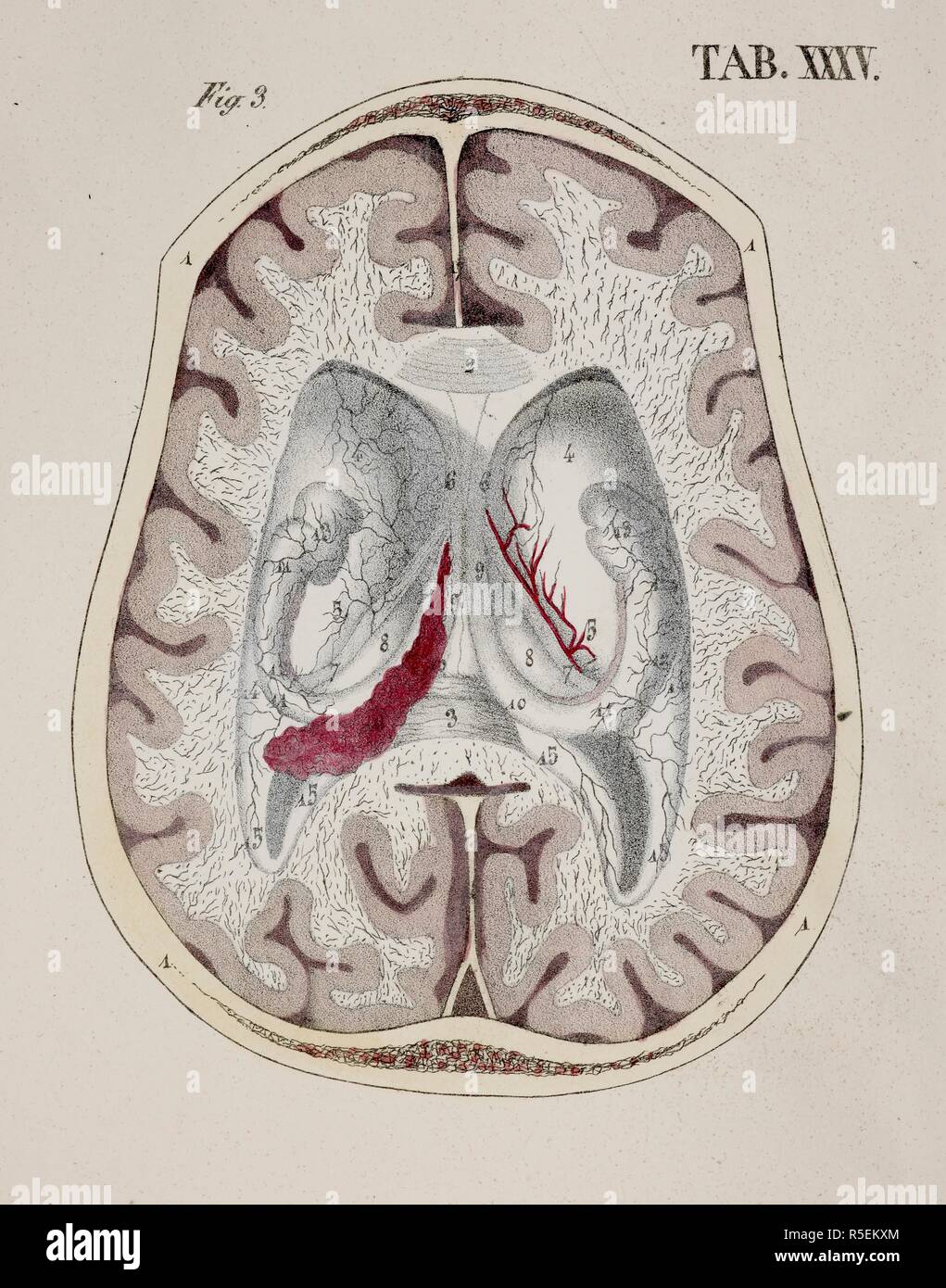 Anatomische Zeichnung. Querschnitt des Gehirns. Planches anatomiques du corps humain executeÌes d'apreÌ € € ™ s les Abmessungen naturelles. Paris Frankreich 1826. Anatomische Drucken des menschlichen Körpers mit natürlichen Dimensionen. Querschnitt des Gehirns. Francesco ANTOMMARCHI, c. Planches anatomiques du corps humain executeÌes d'apreÌ € € ™ s les Abmessungen naturelles, accompagneÌes d'€™ un-Texte explicatif... PublieÌes par le Cte de Lasteyrie. (Explikation des Planches anatomiques, etc.). Quelle: 1899.h.24 Tab.35 Abb. 3. Sprache: Französisch. Stockfoto