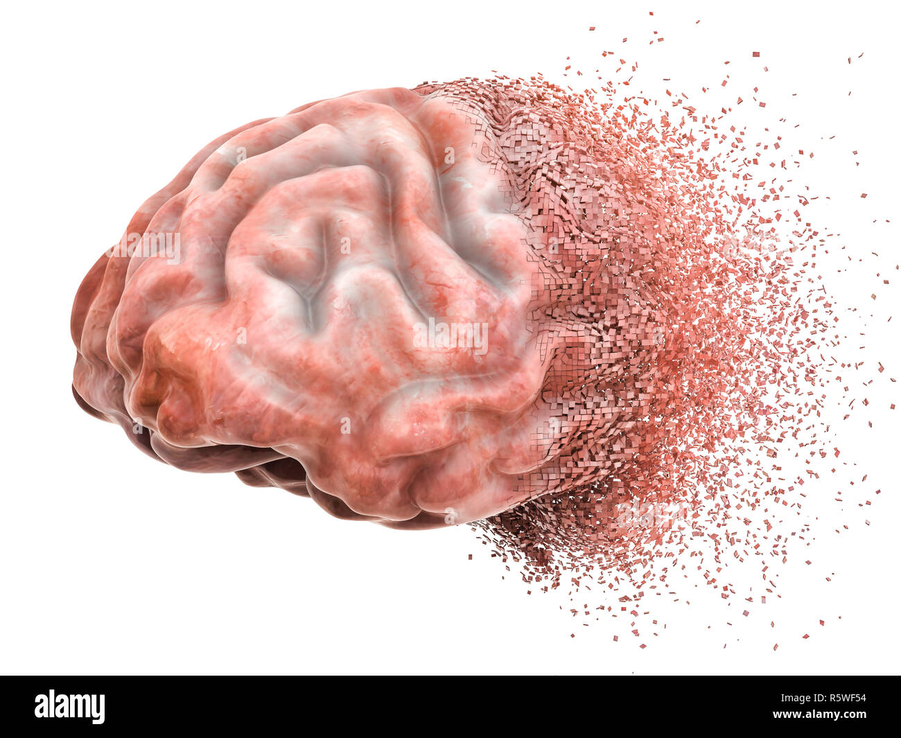 Erkrankung des Gehirns oder Zerstörung, Gedächtnisverlust Konzept. 3D-Rendering auf weißem Hintergrund Stockfoto