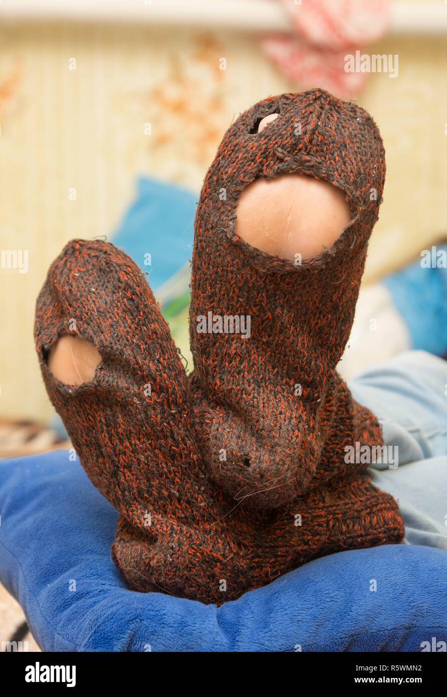 Wollsocken mit riesigen Löchern auf die Beine eines Mannes Stockfoto