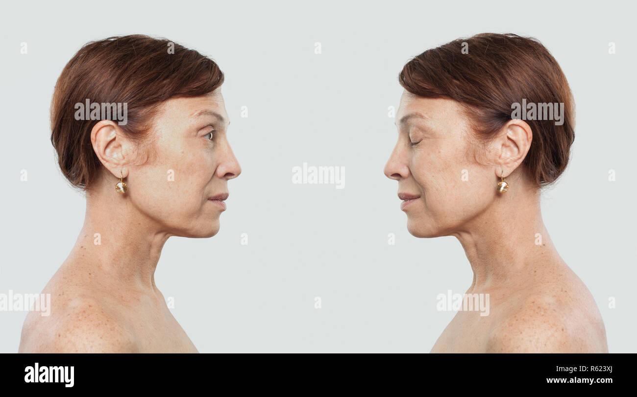 Reife frau portrait. Gesichtsbehandlung, Kosmetik, ästhetische Medizin und plastische Chirurgie Konzept Stockfoto