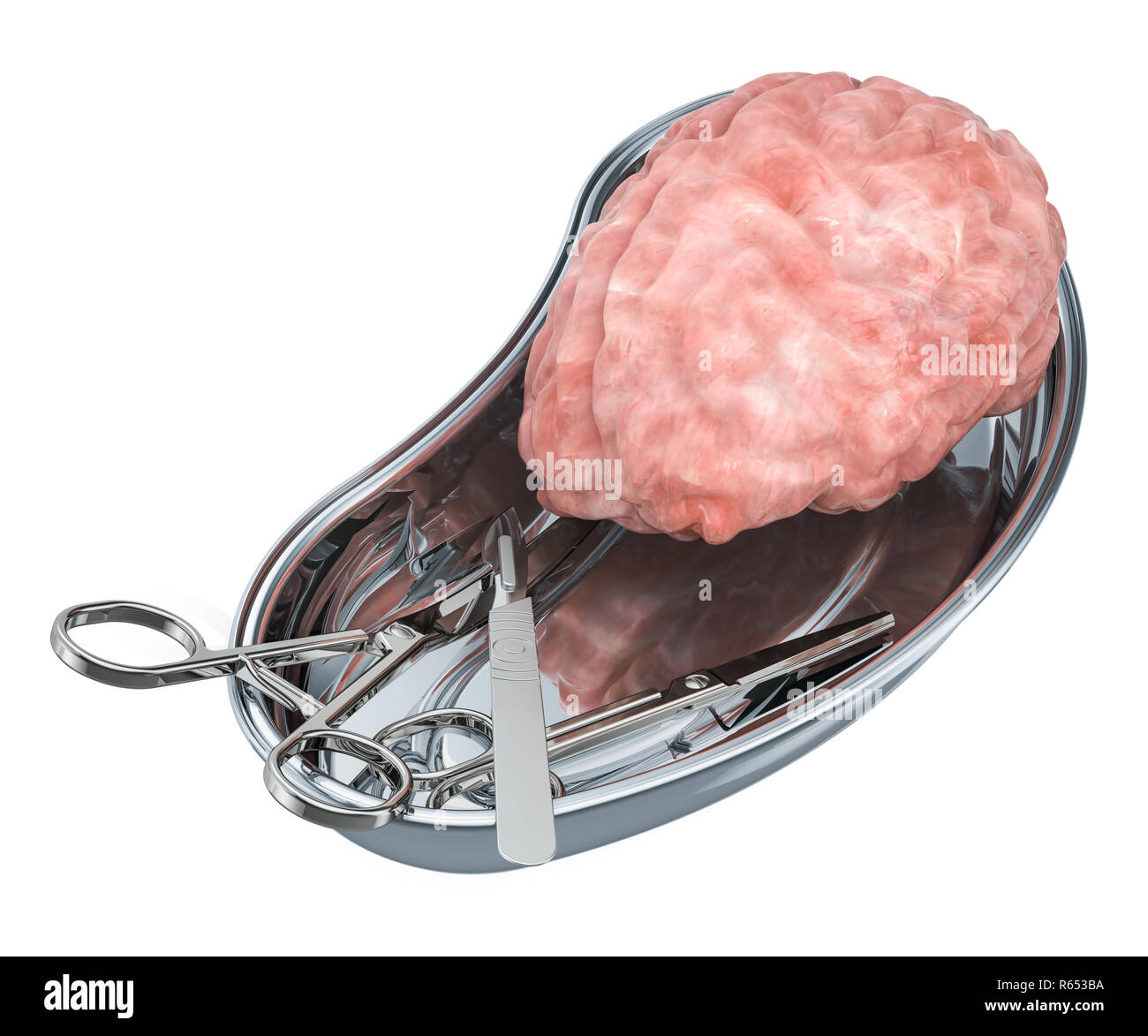 Gehirn Transplantationschirurgie Konzept. Spender Gehirn in metallischen Fach mit chirurgischen Instrumenten, 3D-Rendering Stockfoto