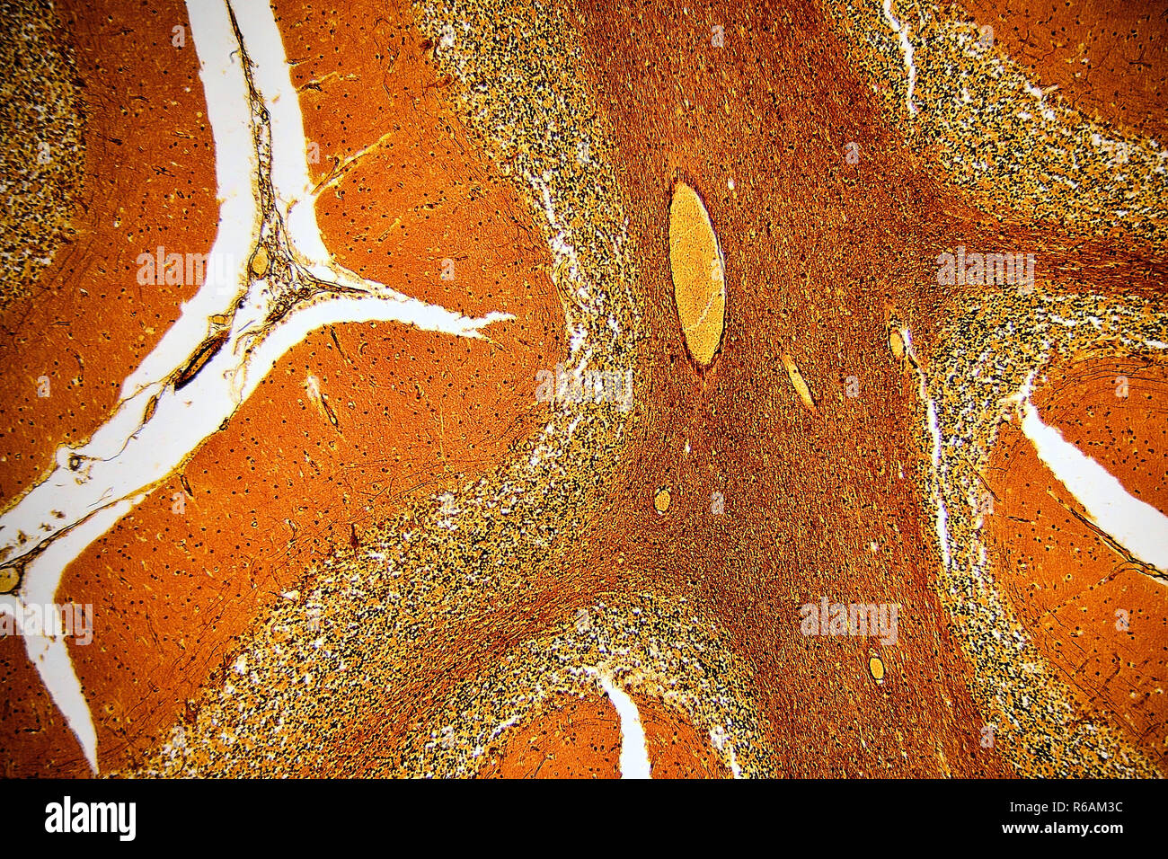 Menschlichen Kleinhirn Histoligical Folie Stockfoto