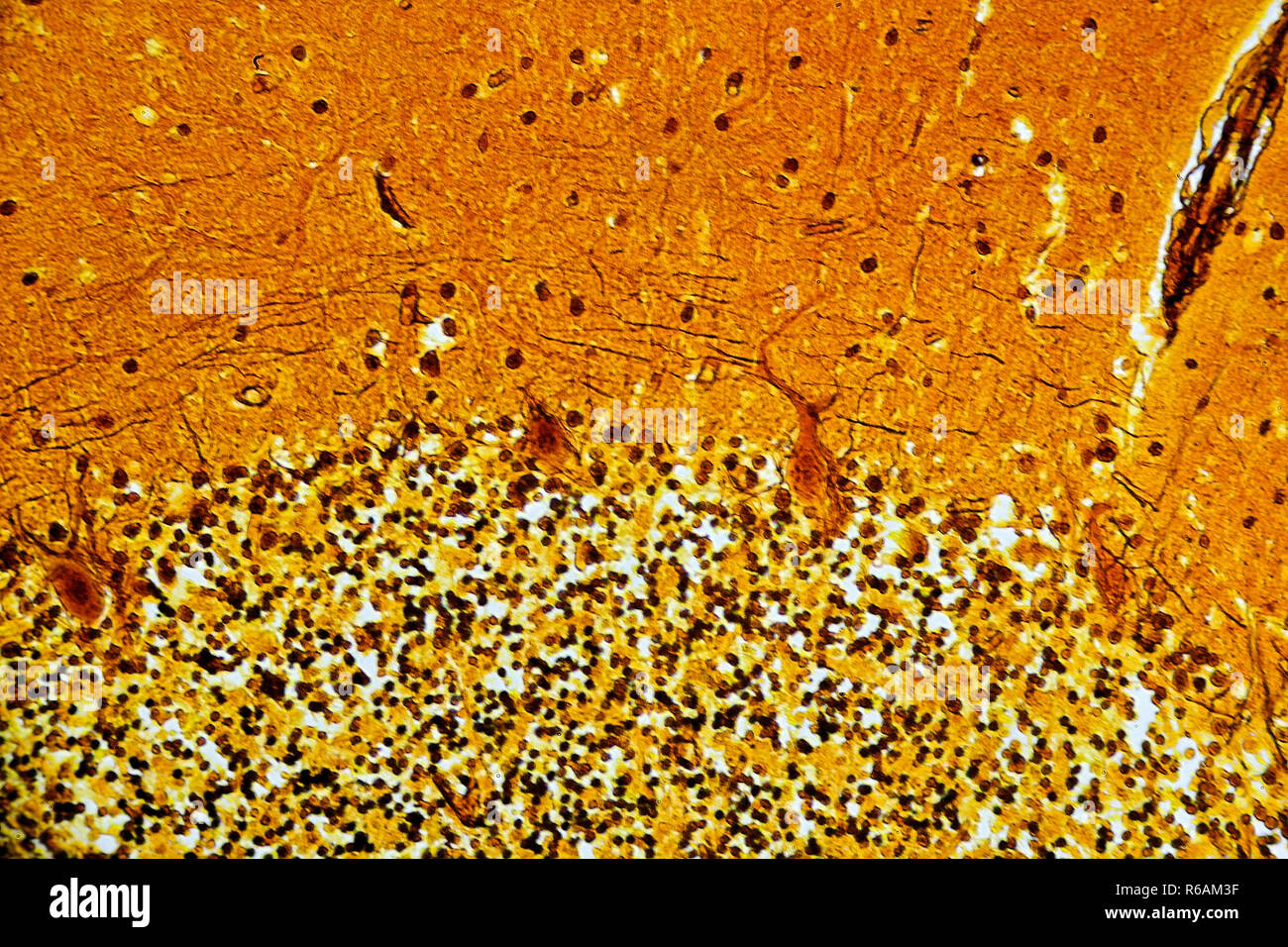 Menschlichen Kleinhirn Histoligical Folie Stockfoto