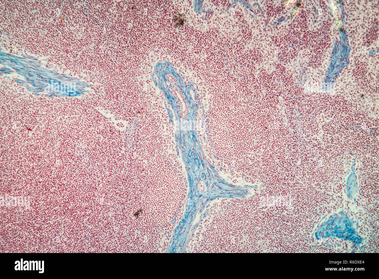 Lymphknoten Gewebe unter dem Mikroskop 100x Stockfoto