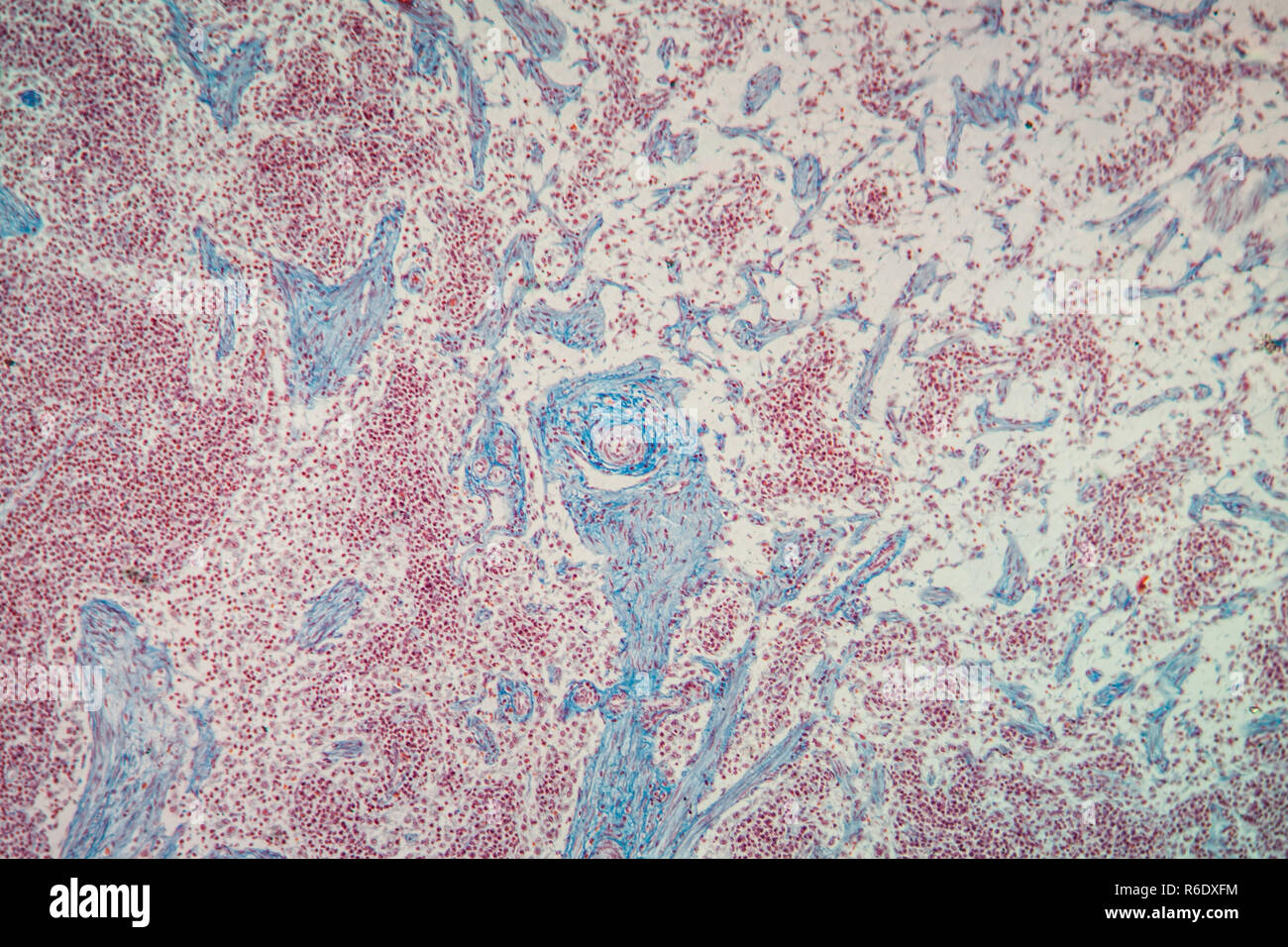 Lymphknoten Gewebe unter dem Mikroskop 100x Stockfoto