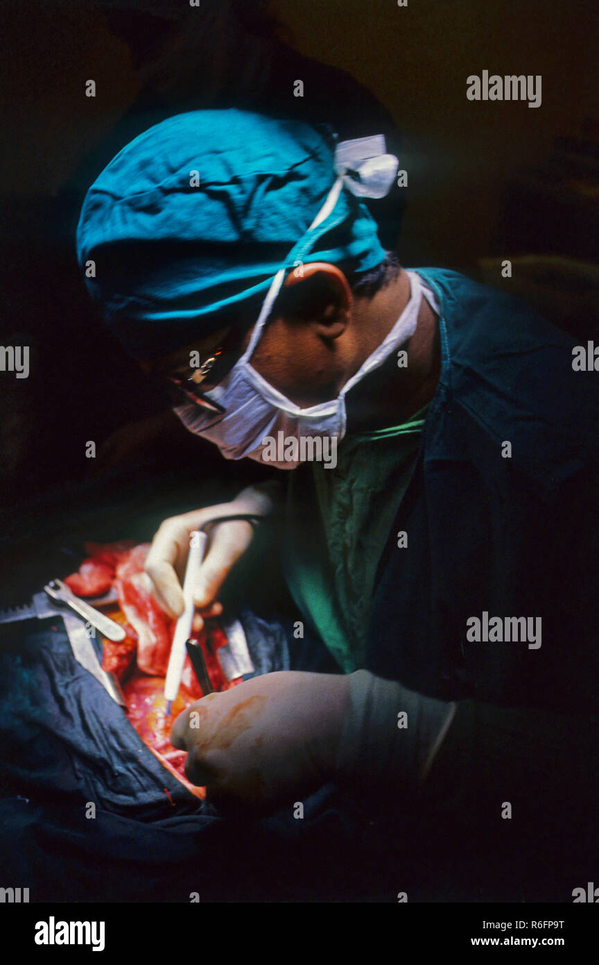 Arzt die Operation am offenen Herzen Stockfoto