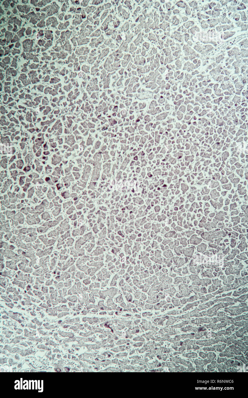 Leber mit Hepatitis Marker unter dem Mikroskop Stockfoto