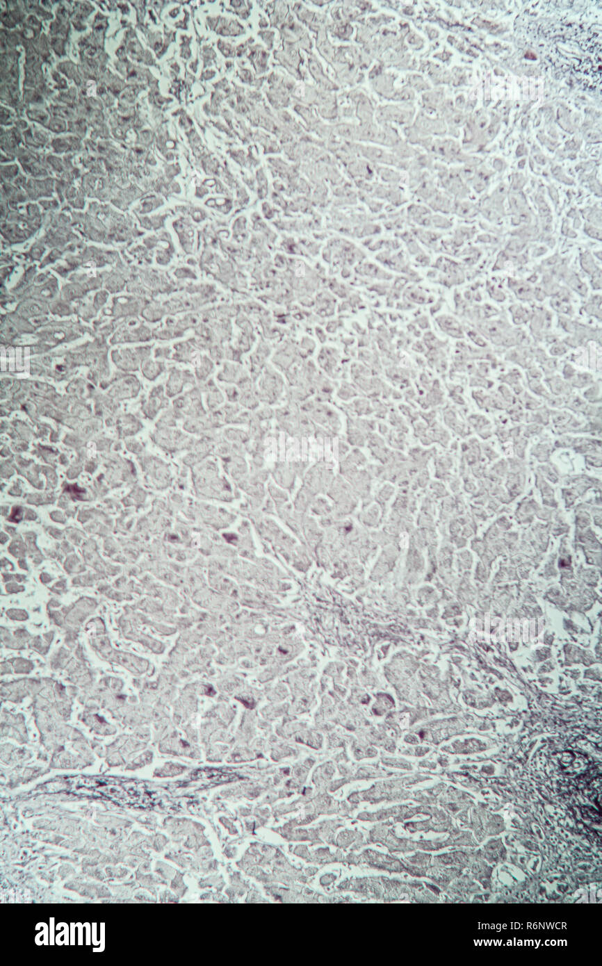 Leber mit Hepatitis Marker unter dem Mikroskop Stockfoto