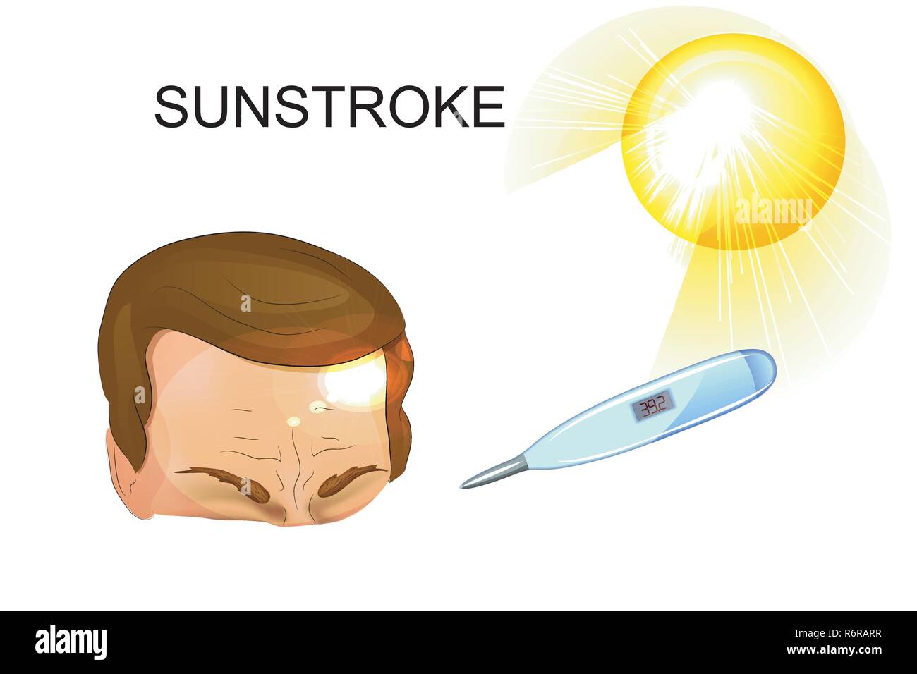 Vektor medizinischen Abbildung der Überhitzung des menschlichen Körpers Hitzschlag Stock Vektor