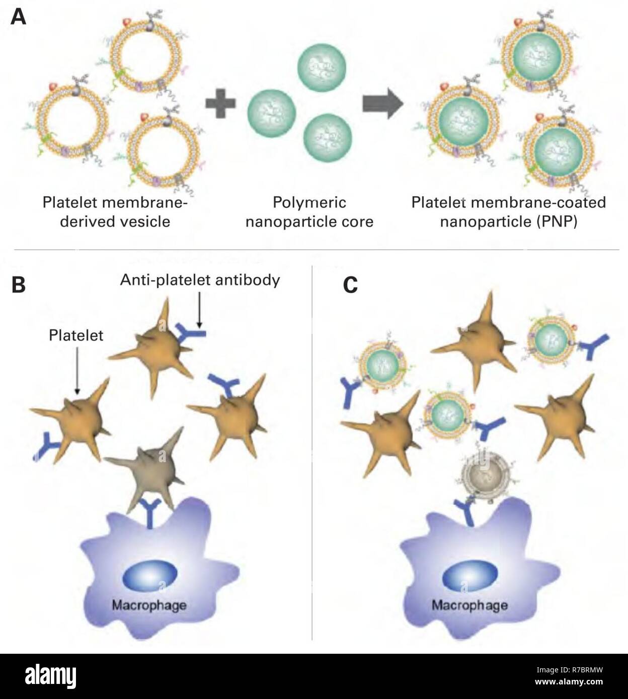 Schematische Darstellung der Thrombozyten Membran beschichtet Nanopartikel (PNPs) für die Behandlung von immun-Thrombozytopenie Purpura (ITP). (A) um PNPs zu fabrizieren, die Plasmamembran von frischen Thrombozyten abgeleitet und dann beschichtet auf Poly (Milchsäure-co-glykolische Säure (PLGA) Polymeren Nanopartikel Kerne, Übertragung von Antigenen Oberflächenmaterial aus den ursprünglichen Zellen auf die Außenseite der Nanopartikel. (B) ohne Behandlung ist ITP gekennzeichnet durch die Bindung von pathologischen Autoantikörper, gesunde Thrombozyten, was in ihren Abstand vom retikuloendothelialen System. (C) bei PNPs verabreicht werden, th Stockfoto