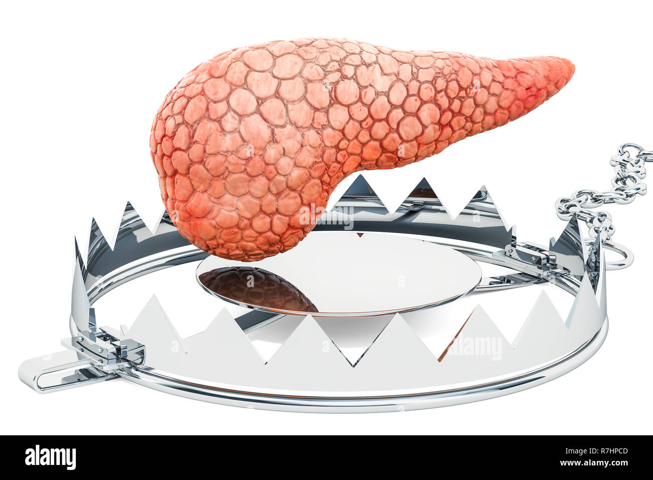 Schilddrüsenerkrankung Konzept. Die menschliche Schilddrüse innen Bär Falle. 3D-Rendering auf weißem Hintergrund Stockfoto