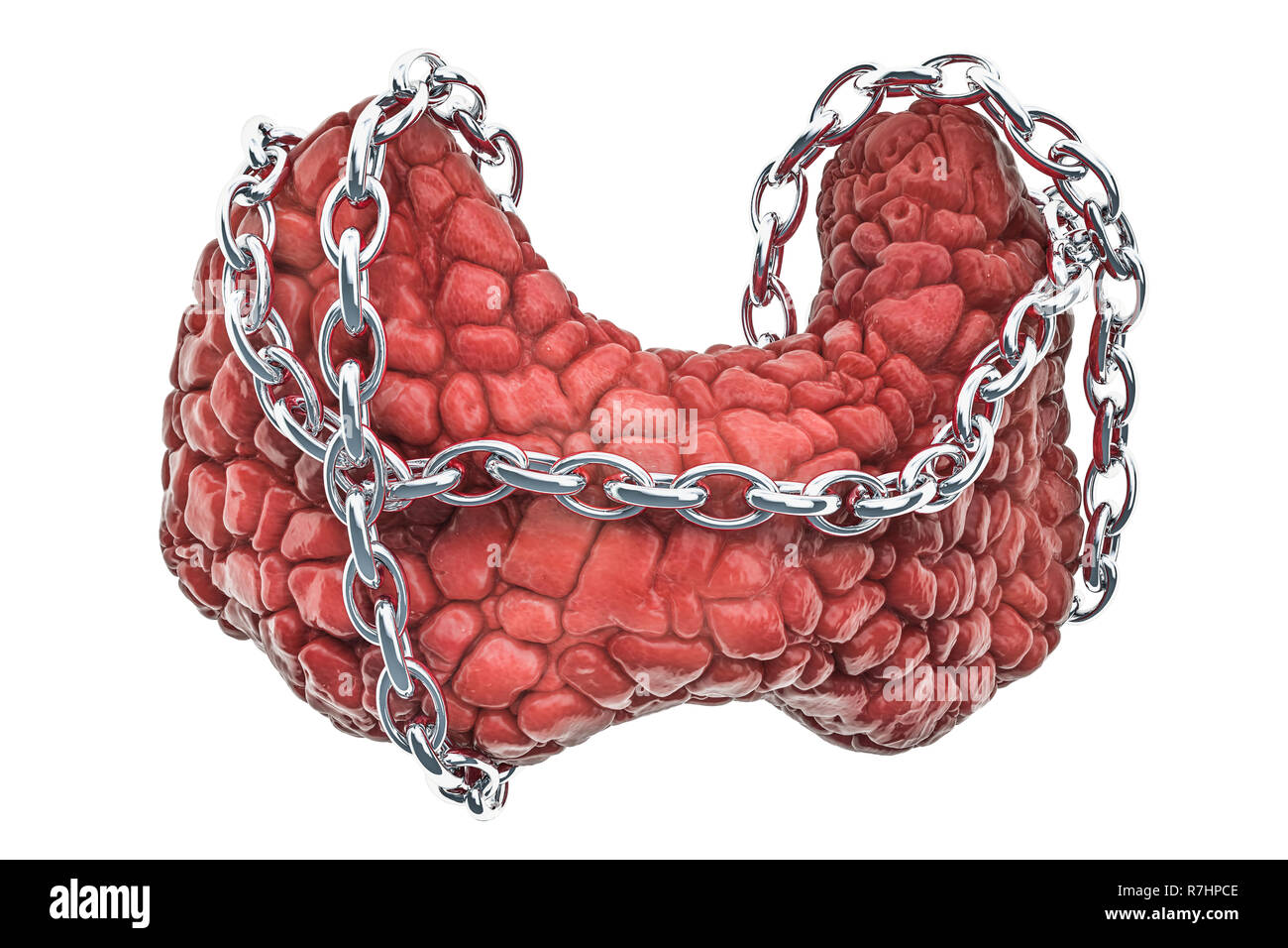 Schilddrüsenerkrankung Konzept. Die menschliche Schilddrüse mit Kette. 3D-Rendering auf weißem Hintergrund Stockfoto