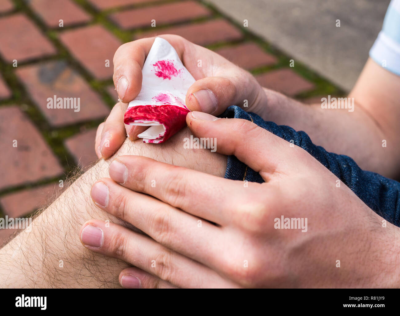 Der Mensch Knie verletzt Stockfoto