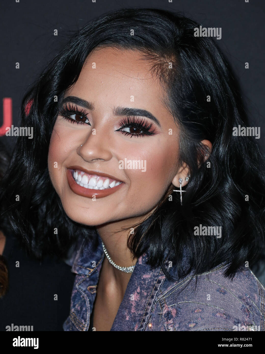 Did becky g get teeth gap removed? 