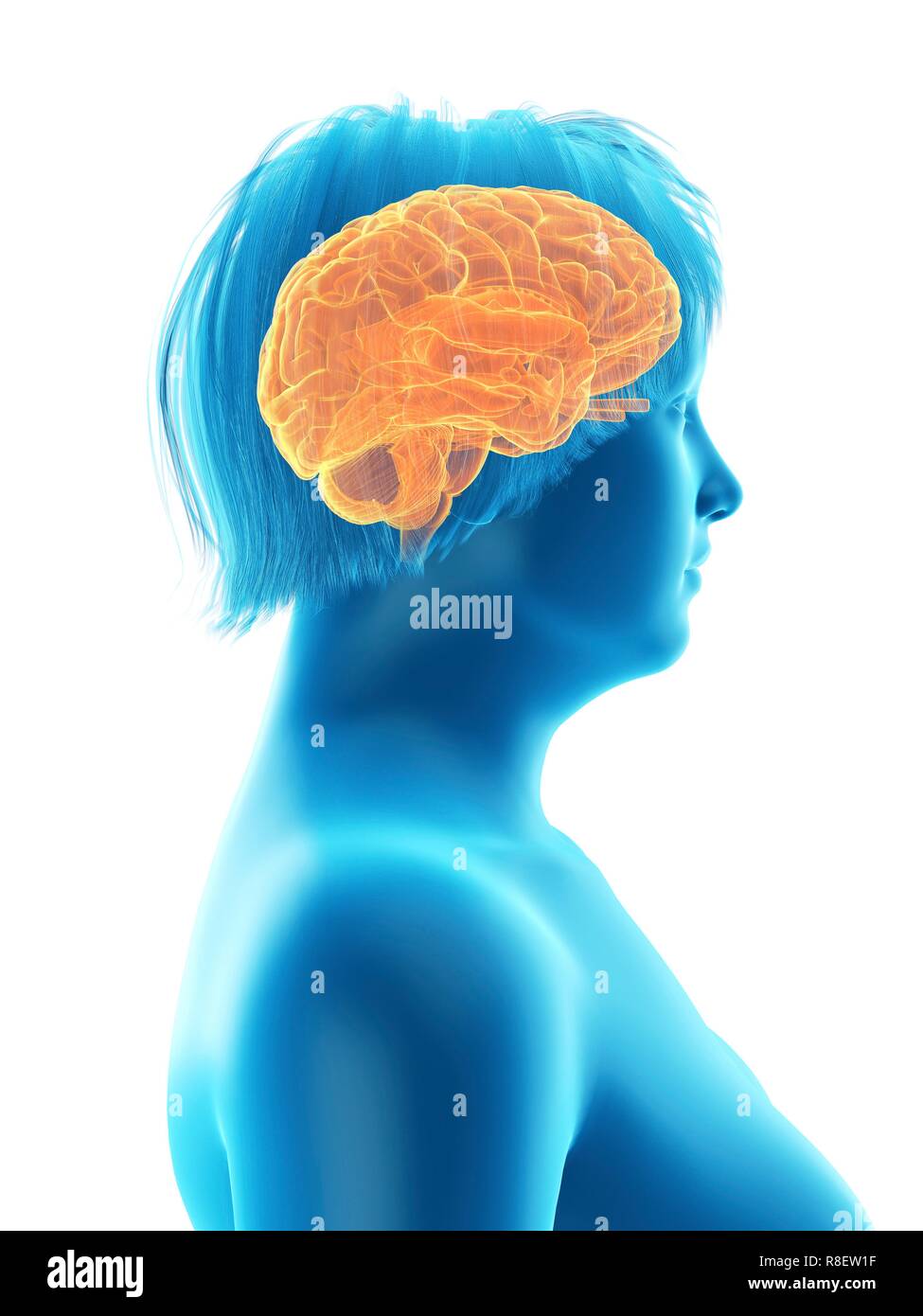 Abbildung des Gehirns eine übergewichtige Frau. Stockfoto