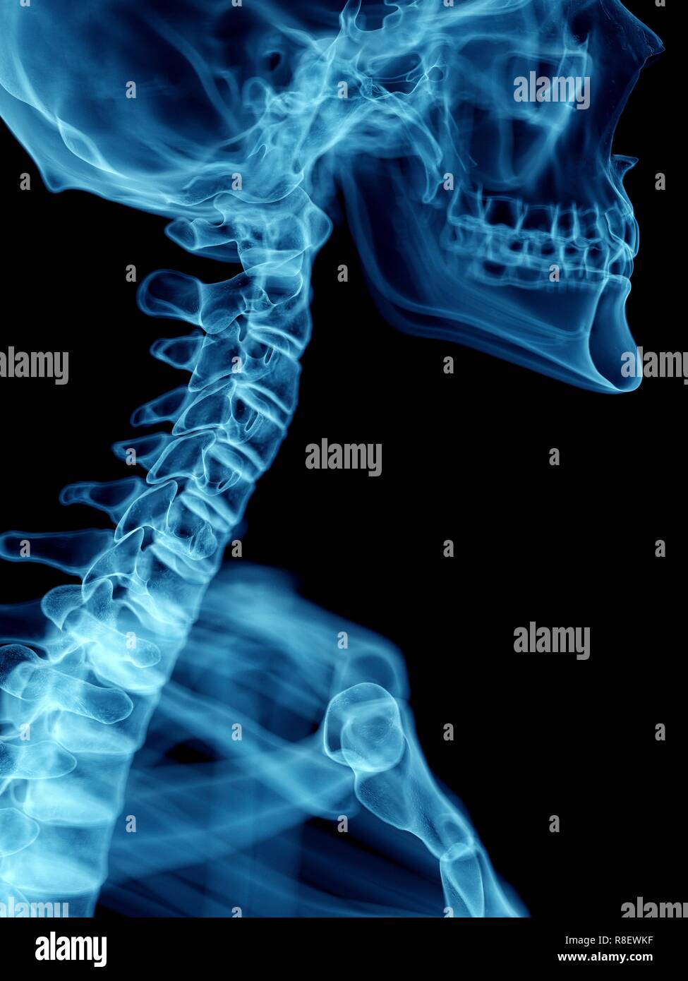 Abbildung der Halswirbelsäule ist ein Mann. Stockfoto
