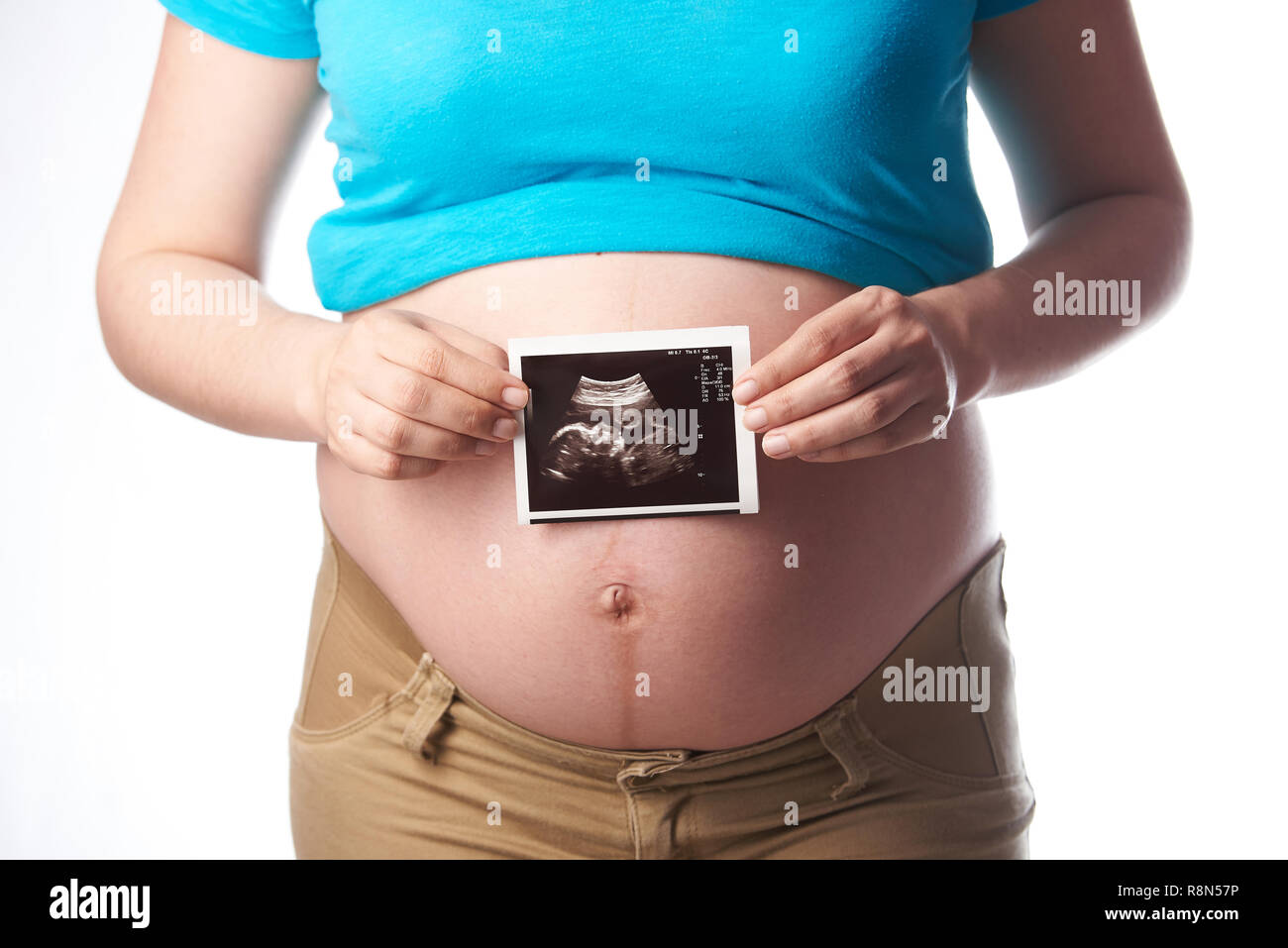 Schwangere Frau halten Ultraschall auf weißem Hintergrund isoliert Stockfoto