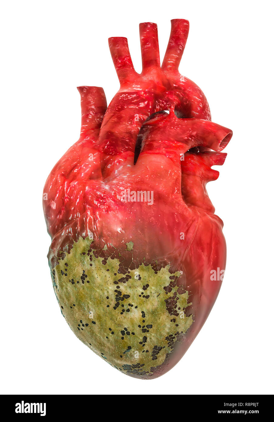 Herzkrankheit Konzept, 3D-Rendering auf weißem Hintergrund Stockfoto