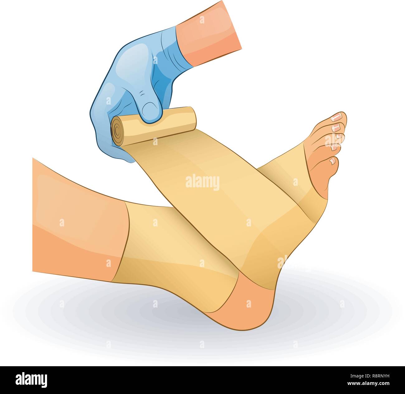 Vector Illustration einer Bandage bei Verletzung des Sprunggelenks Stock Vektor