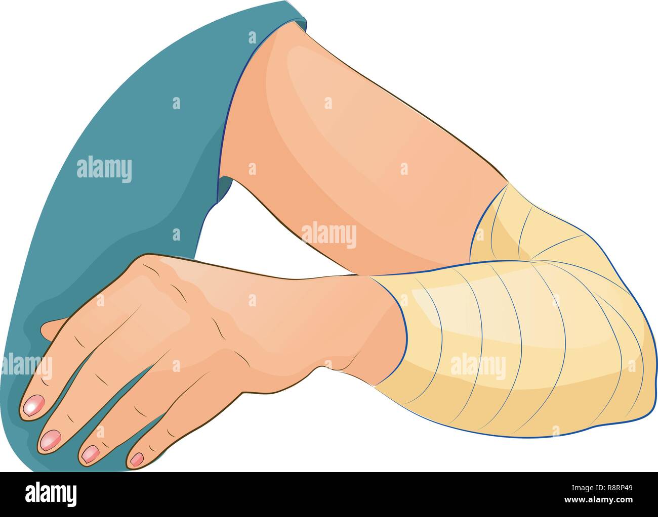 Vector Illustration der Verband an den Ellenbogen Stock Vektor