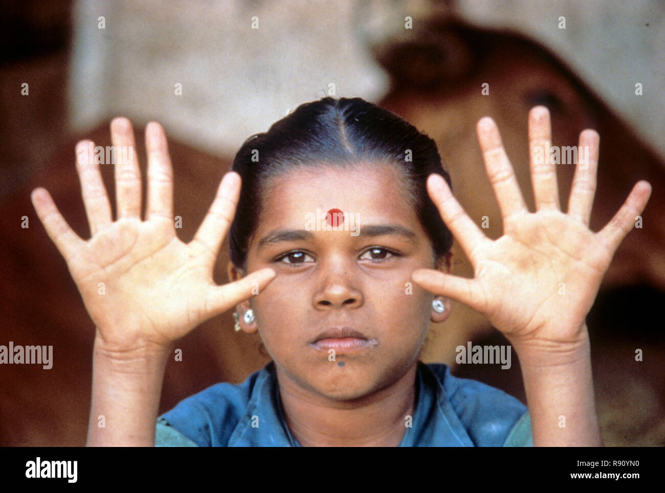 Mädchen, die sechs Finger, Foto Funktion, Indien Stockfoto