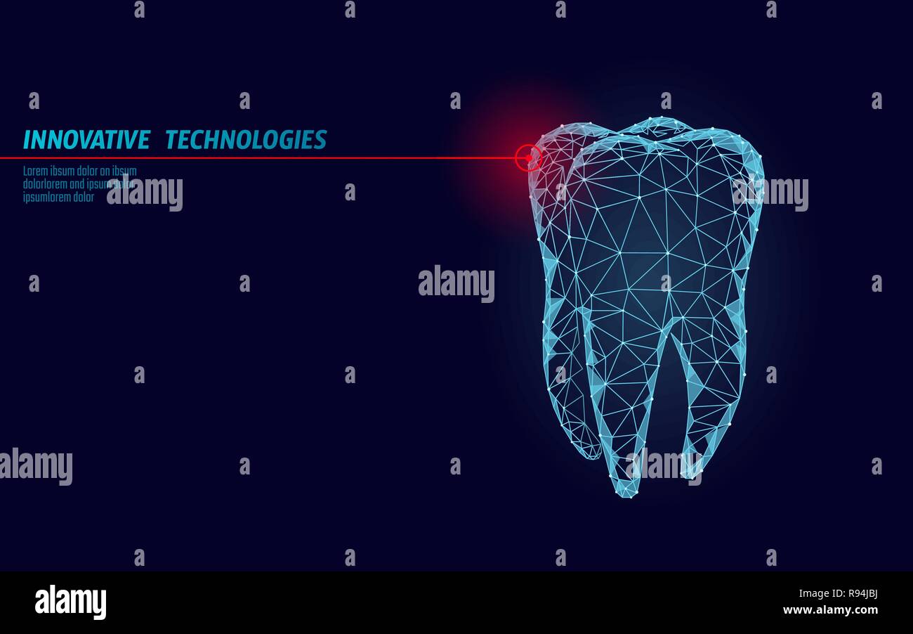 3d-Zahn innovation Laser Zahnheilkunde polygonalen Konzept. Stomatologie symbol Low Poly Dreieck abstrakte oral Dental Medical Care business. Verbunden dot Partikel moderne Render blue Vector Illustration Stock Vektor